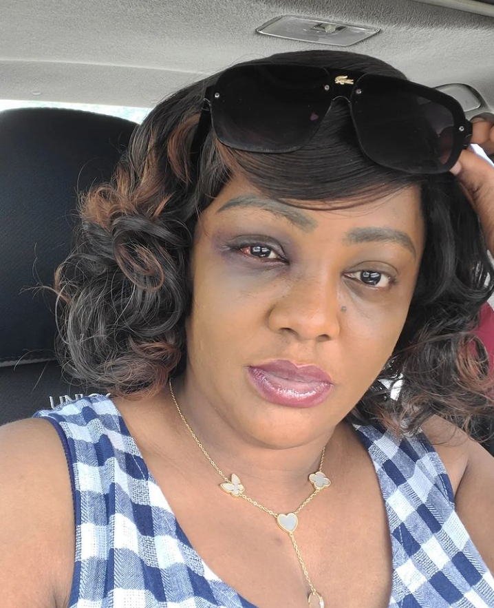 ‘Stop lying, your husband hit you’ – Fans tackle Helen Paul for claiming her ‘black eye’ was a car accident 2 Screenshot 20211011 192703