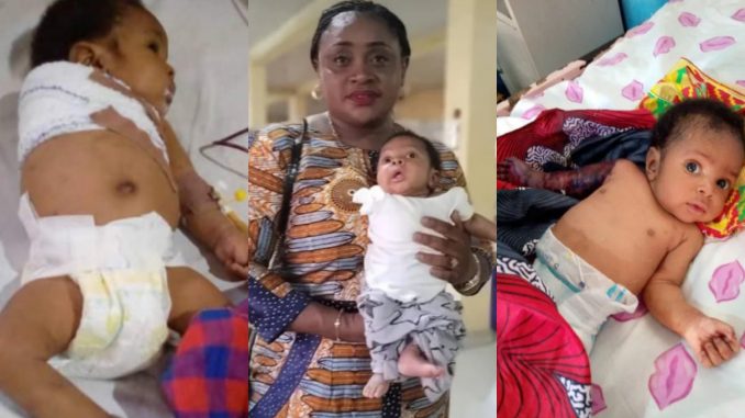 2-Month-Old Baby’s Arm Amputated after His Father Allegedly Beats Him with Hanger for Disturbing His Sleep 2-Month-Old Baby’s Arm Amputated after His Father Allegedly Beats Him with Hanger for Disturbing His Sleep