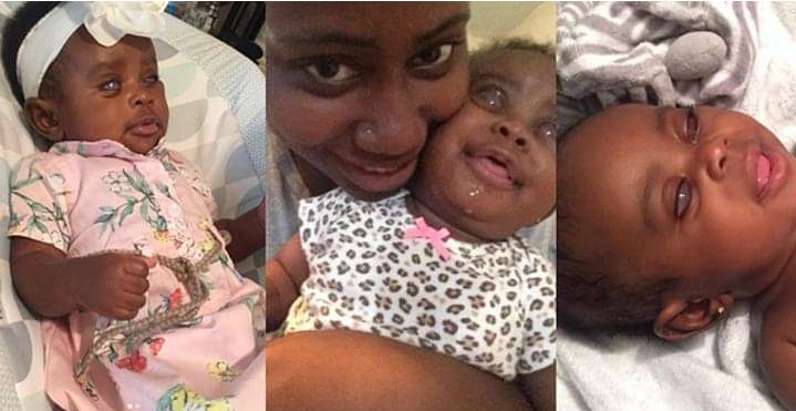 Proud Mom Unashamed Show Off Her Daughter Was Born Blind (Photo) 2 Proud Mom