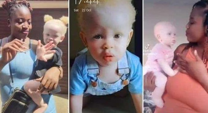 “9 Months in My Belly & You Chose To Look Different”: Mum of Albino Kid Shows Her Off, Her Beauty Causes Stir “9 Months in My Belly & You Chose To Look Different”: Mum of Albino Kid Shows Her Off, Her Beauty Causes Stir