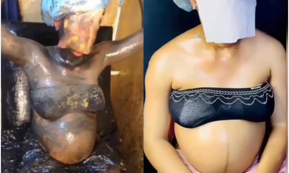 Heavily Pregnant Woman Undergoes Chemical Bleaching tagged lightning glow bath [Video]